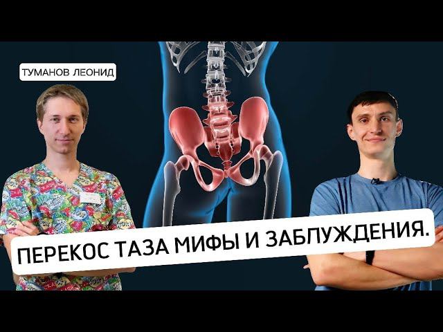 Перекос таза - мифы и заблуждения.