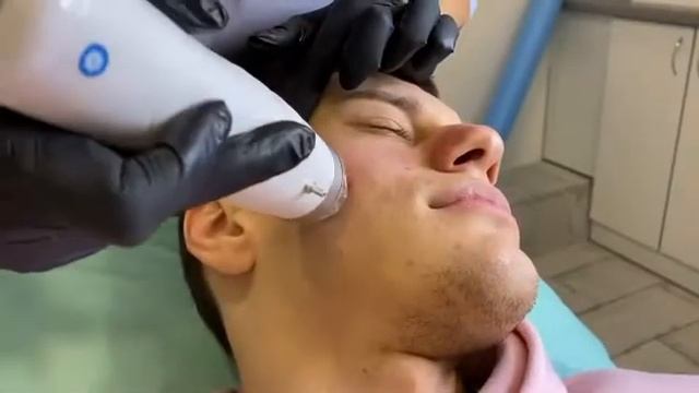 ❓?Что такое радиочастотный лифтинг? ✅? RF (radio frequency) смотреть онлайн