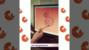 Эмбрион перед переносом