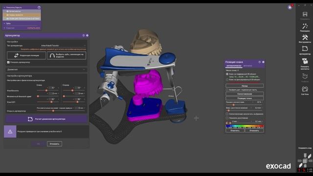 Artex-Fobos-Transfer