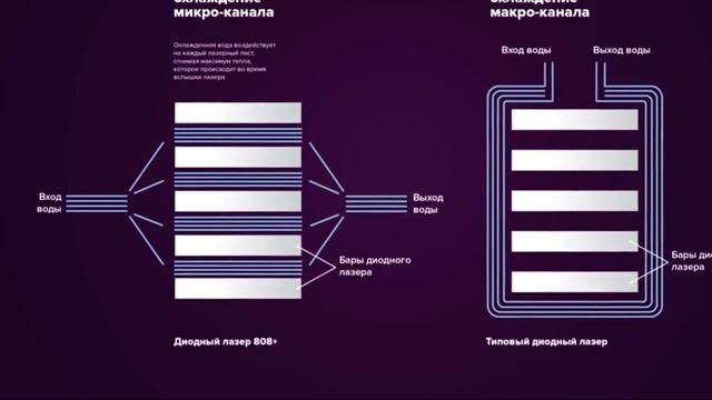 MBT Honor Ice - обзор аппарата для эпиляции смотреть онлайн
