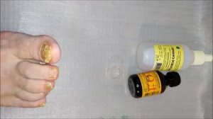 Грибок ногтей. Мой опыт лечения грибка. День шестой. Перекись.