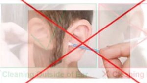 как правильно чистить уши  ? How to clean your ear in 10 sec) Dr.Mathieu