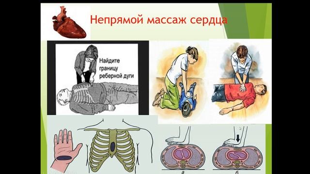 26.05.2019 МСК 14-00 Оказание первой доврачебной помощи при ДТП смотреть онлайн