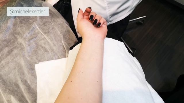 Фотоомоложение: процедура на аппарате «IPL»