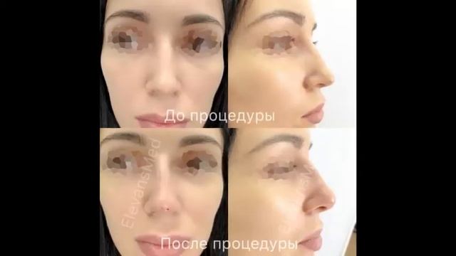 Работы выполненные нитями Elevans