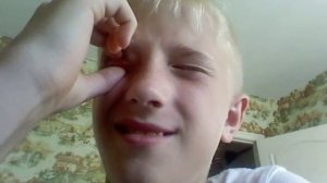 Чувак вывернул веки .-.