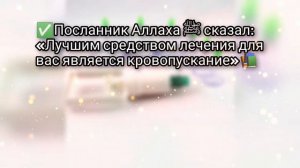 Хадисы о хиджаме I Почему важно лечиться хиджамой I Эти хадисы надо знать