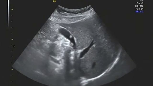 А69 смотреть онлайн