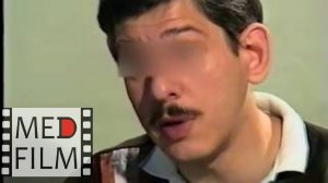 Слабоумие. Социальная сфера. Подбор лекарств. Менингоэнцефалит в детстве © Dementia, social life