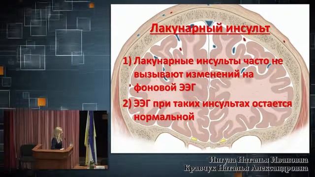 Электроэнцефалография при коморбидных состояниях смотреть онлайн