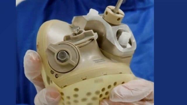 Хирурги впервые имплантировали человеку полностью искусственное сердце.