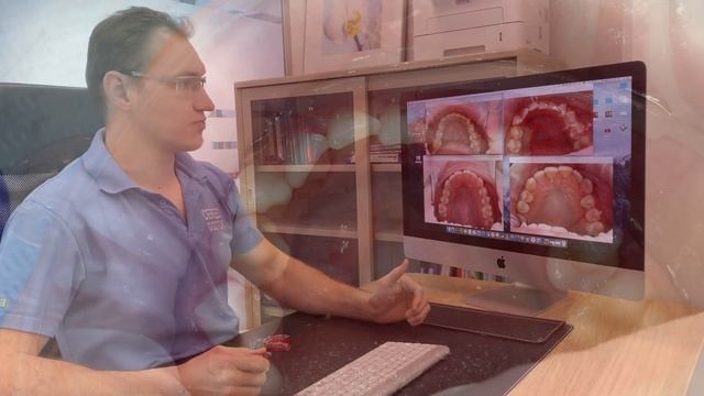 Элайнеры работают 100% Исправление прикуса аналог брекетов в Ульяновске Стас Белоус смотреть онлайн