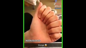 8 ПАЛЬЦЕВ НА ОДНОЙ РУКЕ | БЫВАЕТ ЖЕ ТАКОЕ