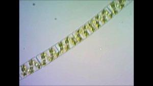 Спирогира under microscope