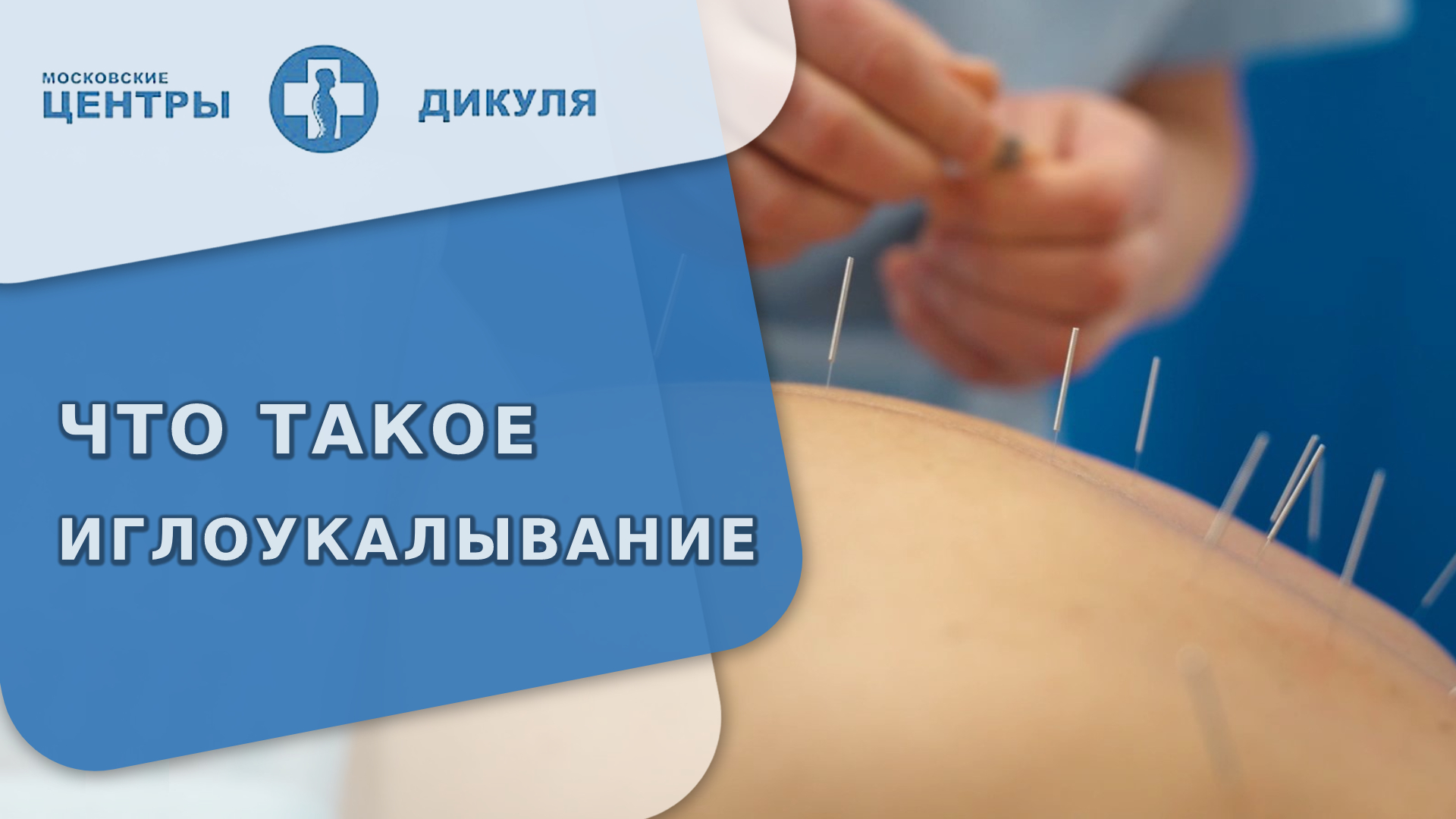 ? Что такое иглоукалывание, какие к нему показания, противопоказания. Что такое иглоукалывание. 18+