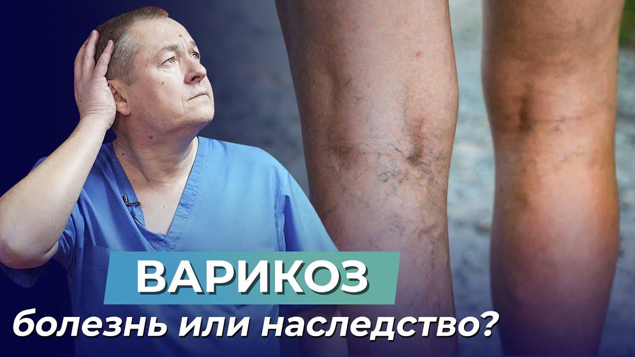 ВАРИКОЗ - НЕ ПРИГОВОР! Упражнение, которое ПОМОЖЕТ ВЫЛЕЧИТЬ варикозное расширение вен!