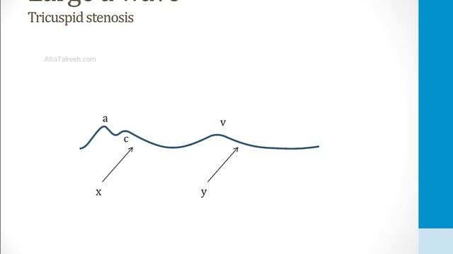 Кардиология USMLE - 1. Анатомия и физиология - 8.Отслеживание венозного давления