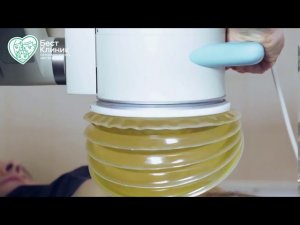 Мочекаменная болезнь Методы лечения мочекаменной болезни