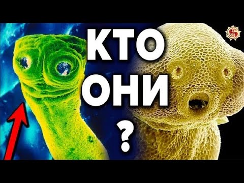 ОНИ ВНУТРИ НАС ? ПАРАЗИТЫ - ГЛАВНОЕ ЧТО НУЖНО ЗНАТЬ О НИХ И КАК ОТ НИХ ИЗБАВИТЬСЯ
