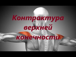 Плечо - запястье. Активация.