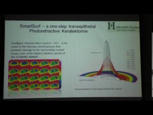 Хауг Х.-П. (Германия) SmartSurf - одноэтапная трансэпителиальная кератэктомия