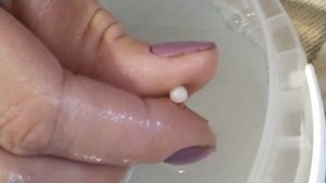 Склеились пальцы на руке суперклеем.  Как разделить пальцы от суперклея?