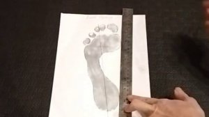 Диагностика плоскостопия - плантография