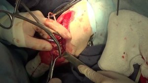 Хирургическое лечение перелома плечевой кости у собак