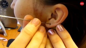 Ear piercing/прокол уха в домашних условиях