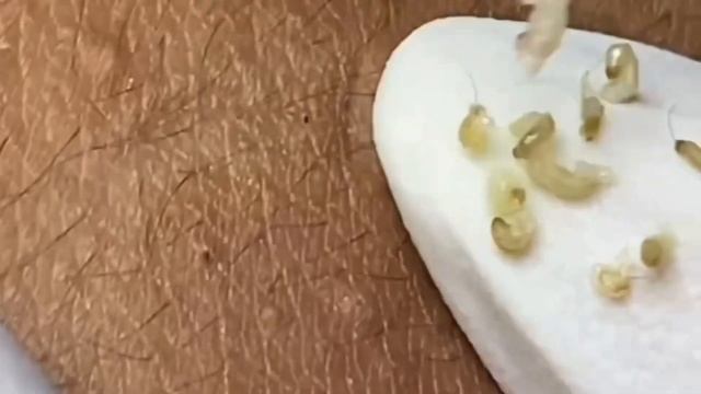 Смотри как ДАВИТЬ ПРЫЩИ на спине