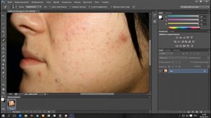 Простой способ удалить дефекты на лице фотошопом
