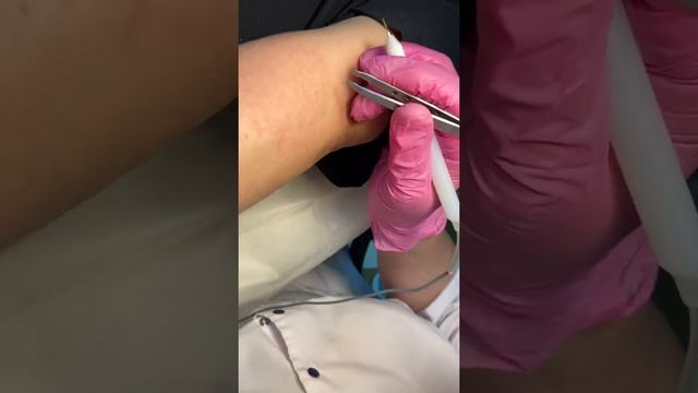 Электроэпиляция обучение смотреть онлайн