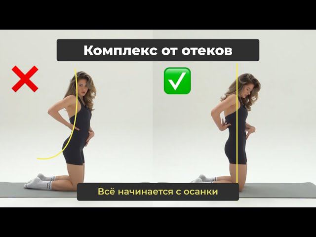 Комплекс от отеков | ALEX FORM смотреть онлайн