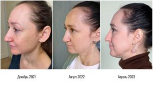 КАК ВОССТАНОВИТЬ РОСТ ВОЛОС: ОТЗЫВ НА ЯПОНСКУЮ РАСЧЕСКУ BAROCCO