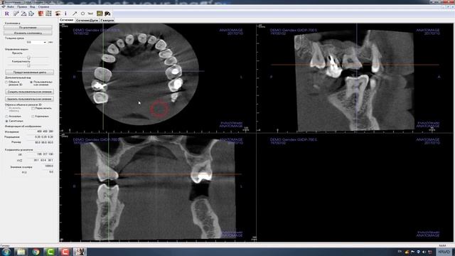 Открытие диска с исследованием InVivo™ смотреть онлайн