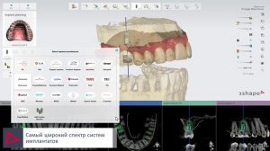 3Shape Implant Studio 2019 – Планирование имплантатов и изготовление хирургических шаблонов - A dem