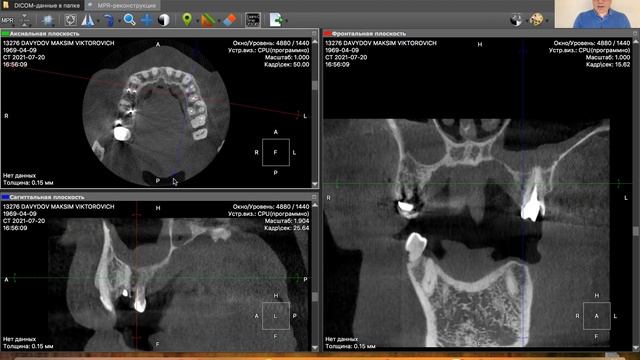 Описание КЛКТ (Д.М.В.) смотреть онлайн