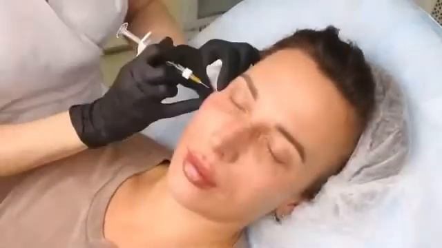 Гармонизация и омоложение лица в клинике Ирины Баратовой смотреть онлайн