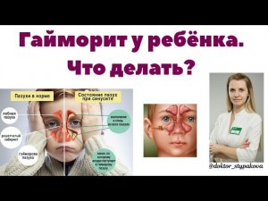 Гайморит у ребёнка.Симптомы болезни.Отличия гайморита от обычного ринита у детей.