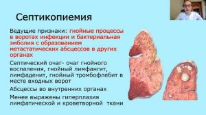 Сепсис. Патологическая анатомия