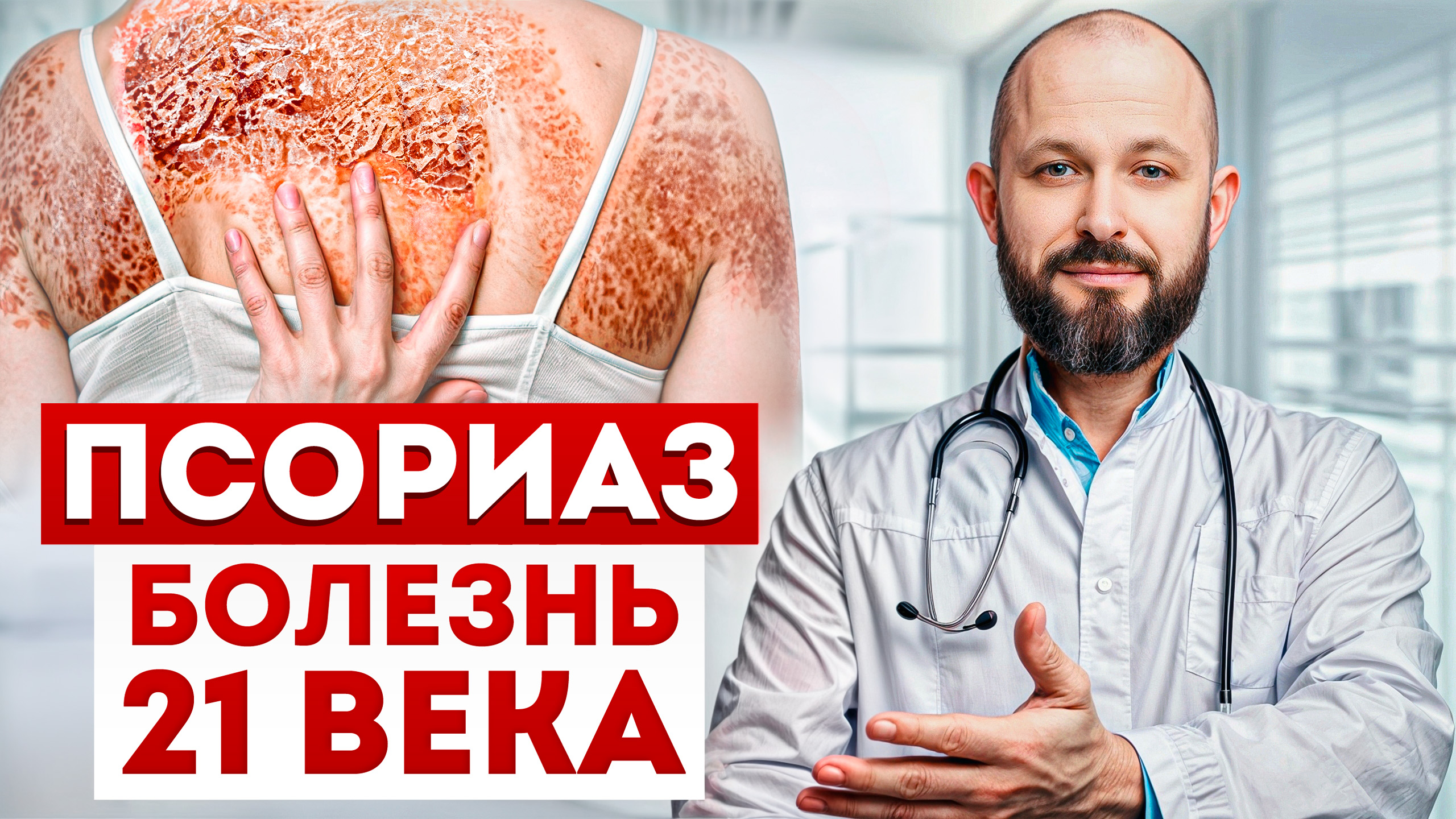 Как вылечить псориаз с помощью ОДНОЙ свечки? / После ЭТОГО ваша кожа будет ЧИСТОЙ и КРАСИВОЙ!
