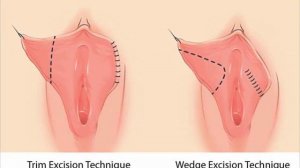 योनि कितने प्रकार की होती है - Types of Yoni in Hindi