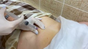 Озонотерапия