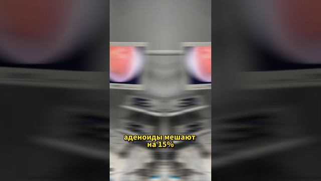 Лор-Врач Разаков Эльдар Мазумович провел эндоскопический осмотр и обнаружил увеличенные аденоиды смотреть онлайн