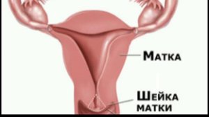 БАЧАДОН БУЙНИ ЭРОЗИЯСИ, САБАБЛАРИ, БЕЛГИЛАРИ ВА ДАВОЛАШ