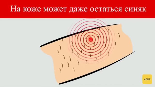 Укусы Насикомые