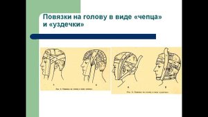 Виды повязок