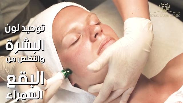 royal profacial смотреть онлайн