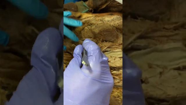 Опх тыки передней брюшной стенки смотреть онлайн